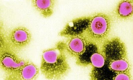 Quali sono i sintomi del coronavirus negli esseri umani?